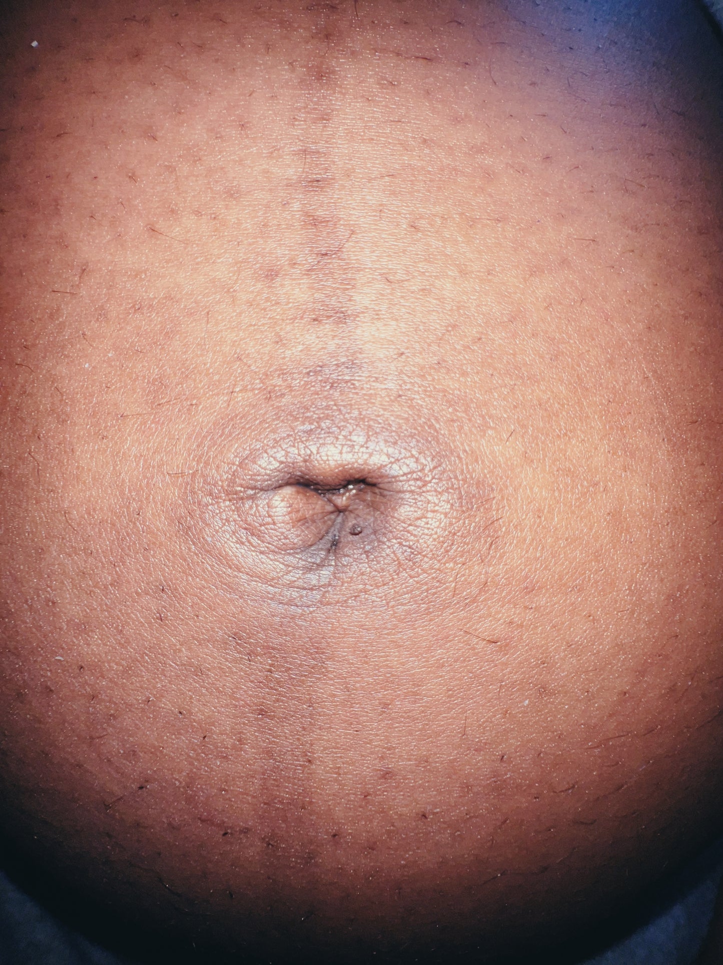 Noni Inbetweenie (Pregnant)